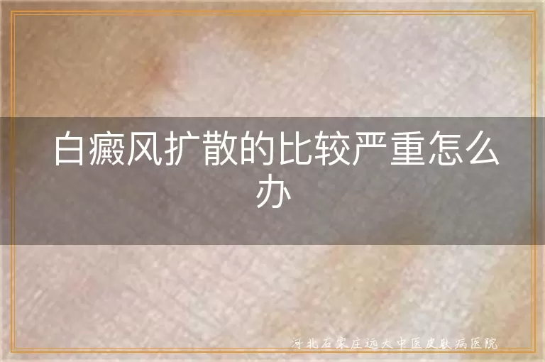 白斑快速增多应对办法,白癜风扩散严重如何救,身上突然冒白斑的紧急措施