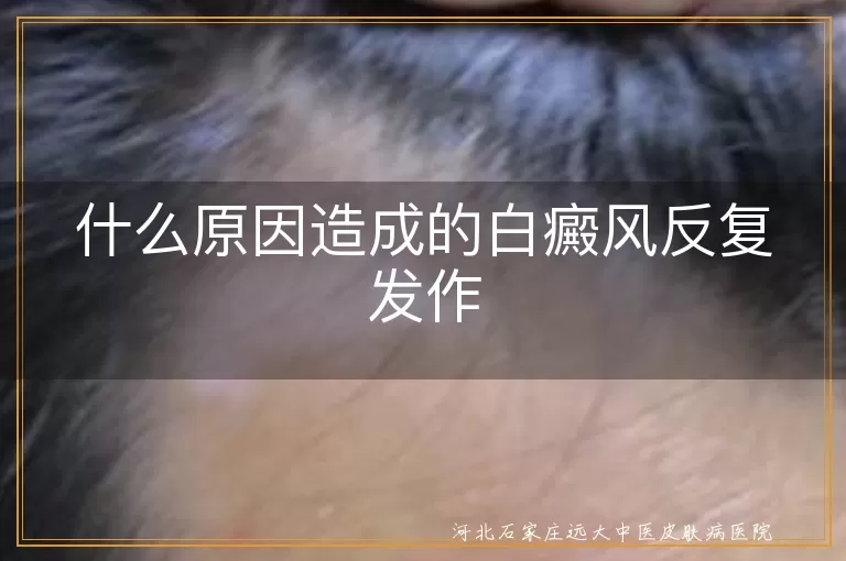 白癜风反复发作的根源,白斑病情为何反复,白癜风反复难控因素