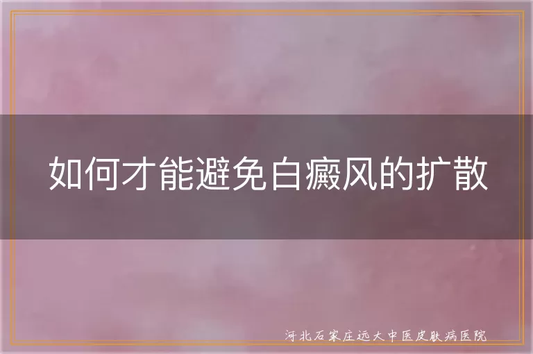 `白癜风扩散如何预防,白斑病情控制方法,避免白癜风蔓延技巧`