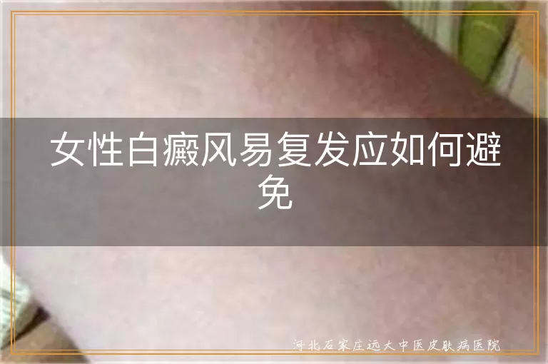 女性白癜风患者复发预防方法,女性白斑反复发作如何避免,女性白癜风日常护理注意事项