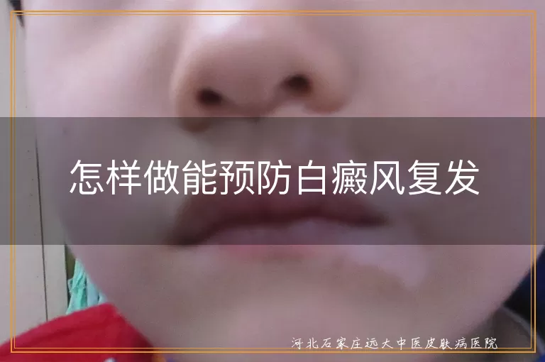 怎样预防白癜风复发效果好,白斑怎么防止复发更靠谱,预防白癜风复发的有效方法