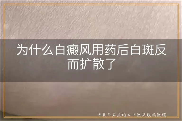 为什么白癜风用药后白斑反而扩散了