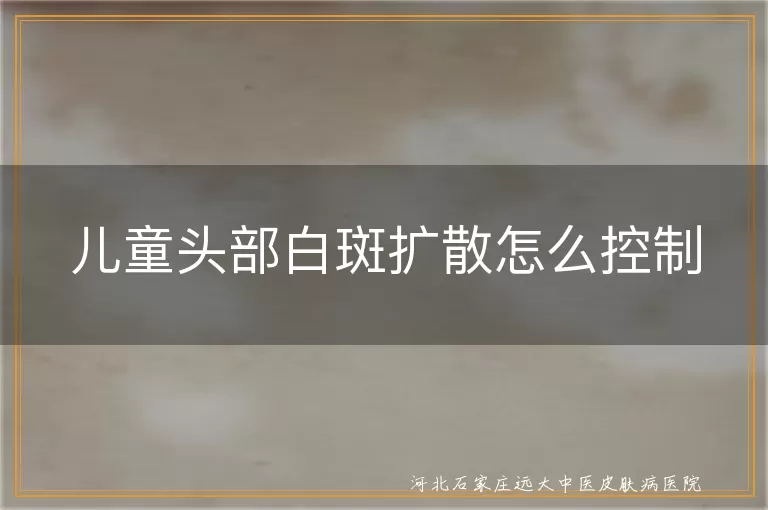 儿童头部白斑扩散怎么控制,孩子头皮白癜风扩散怎么办,儿童头部长白斑如何阻止扩散