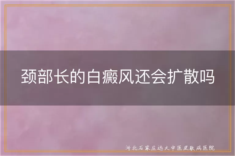 颈部长的白癜风还会扩散吗