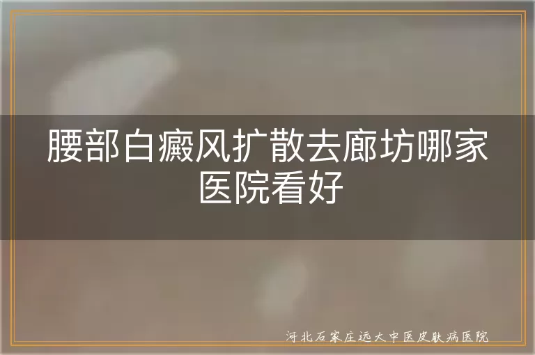腰部白癜风扩散去廊坊哪家医院看好