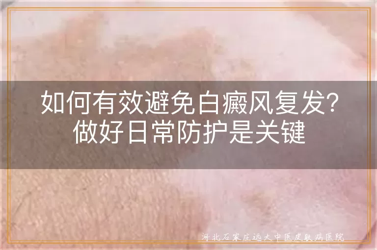 白癜风复发怎么预防,白斑消失后如何避免复发,白癜风好了怎样防止再长