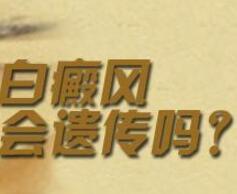 我这是长的白癜风吗
