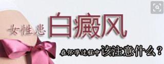 治疗白癜风患者想要的治疗手艺