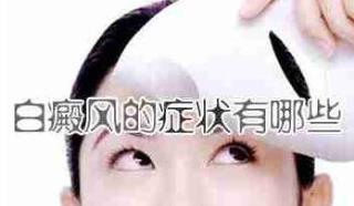 白癜风治疗的特性
