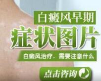 治疗男性白癜风一般来说须要破耗多长时辰