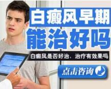 白癜风发生的缘由终究有哪些