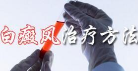 石家庄能治好儿童白癜风的医院