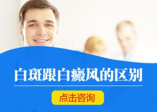 治疗急性白癜风的格式有什么
