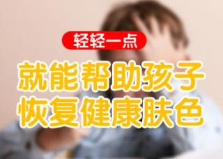 白癜风早期有哪些默示