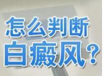 石家庄哪家病院能治疗白癜风