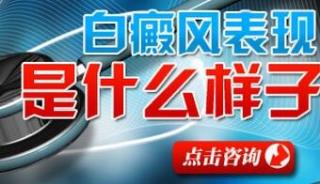 石家庄哪个病院治白癜风下场好一些