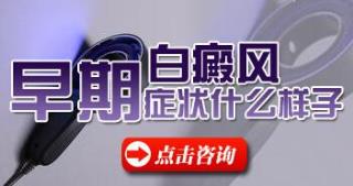石家庄治白癜风病院哪家斗劲好