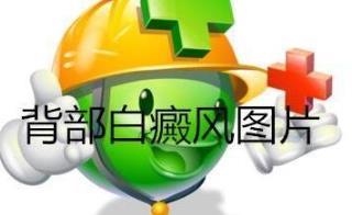 白癜风病发的症状有哪些