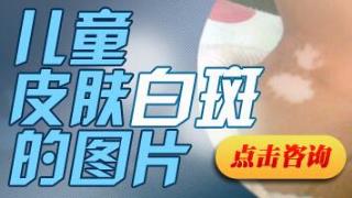 白癜风治疗时期脱皮是怎样回事