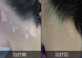 石家庄看好白癜风医院怎年么样